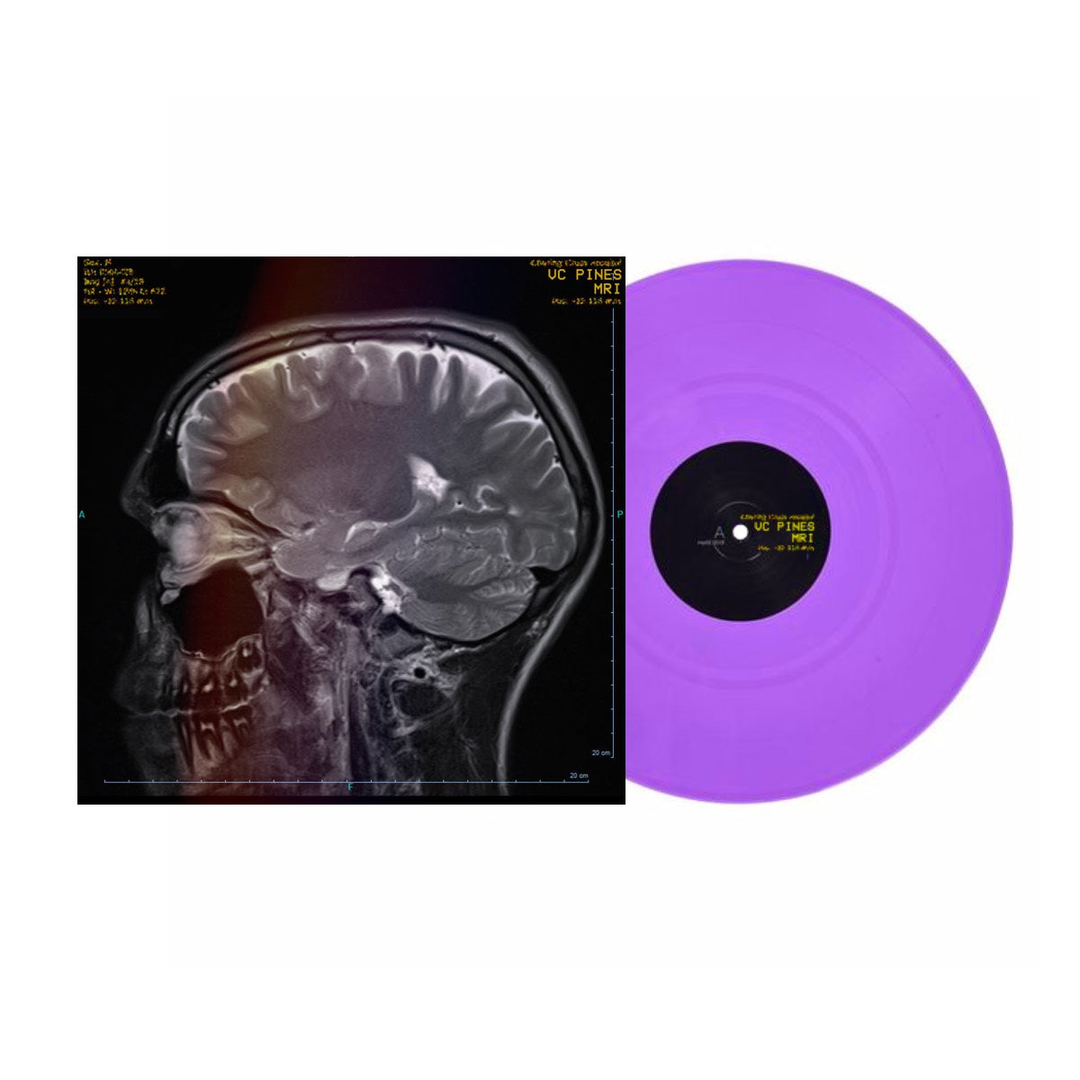 VC Pines - MRI - Vinyl