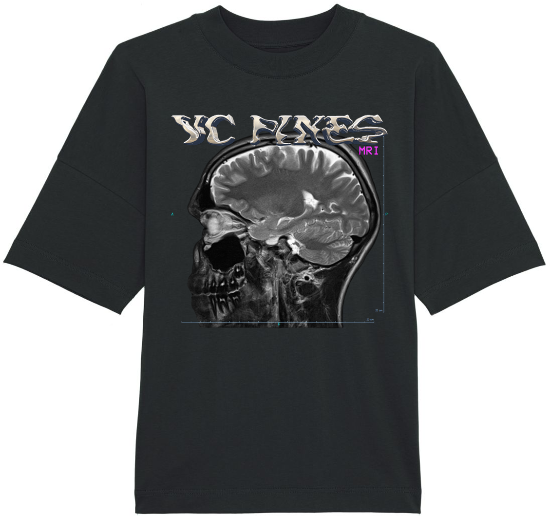 VC Pines - Brain Tee - Black
